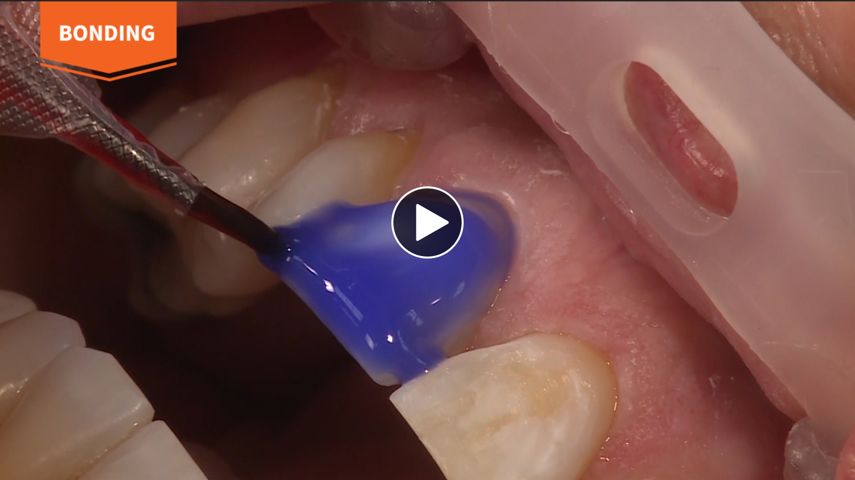 Ultradent Restorative Solutions